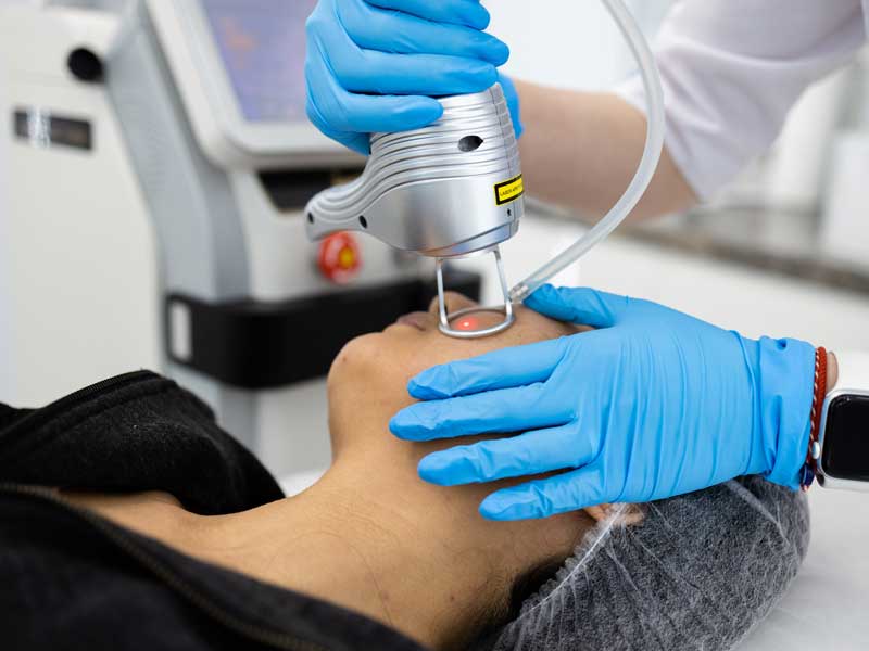 How Fractional CO2 Laser Resurfacing Works