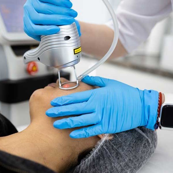 How Fractional CO2 Laser Resurfacing Works